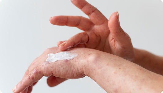 The Experts Guide on Managing Eczema