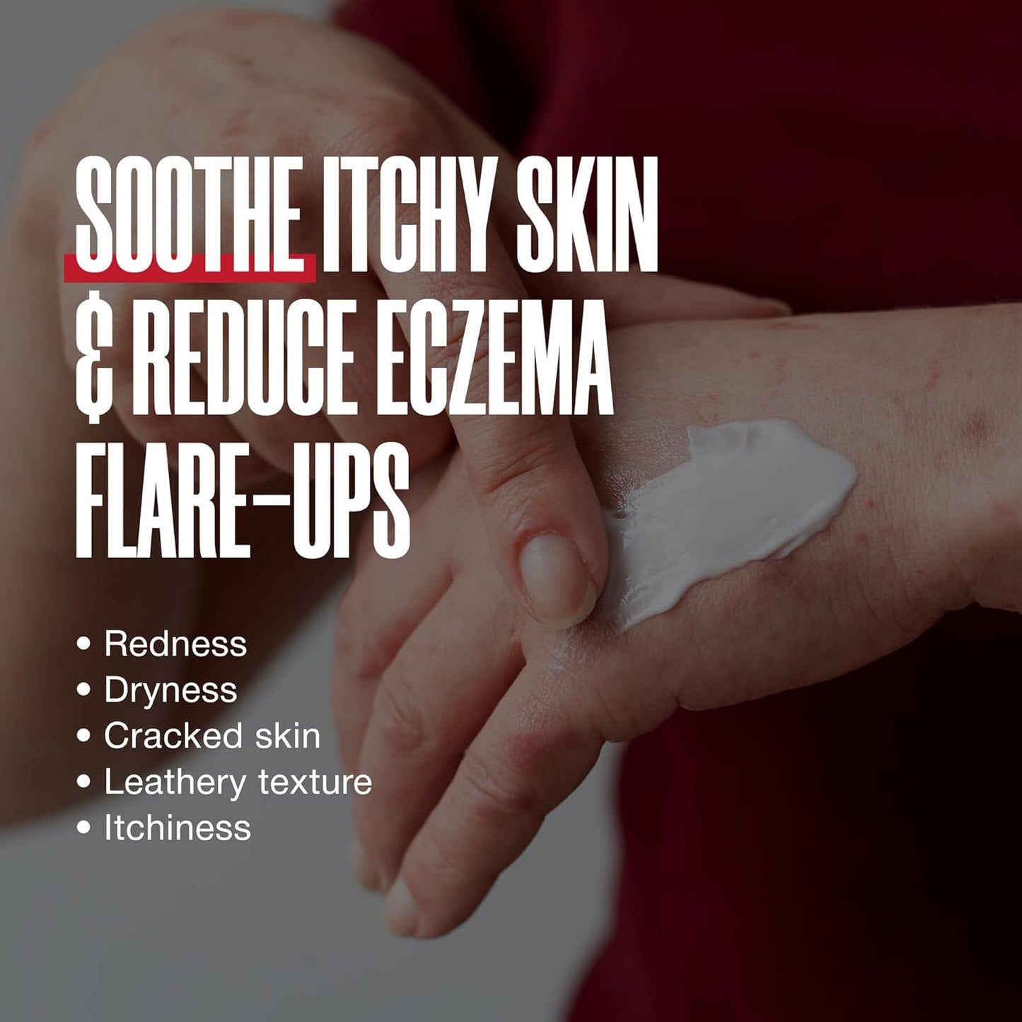 Eczema Repair Cream